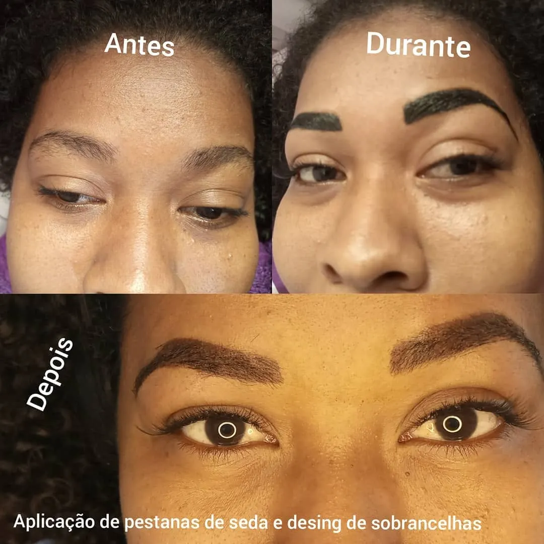 Finadepilacoes (3)